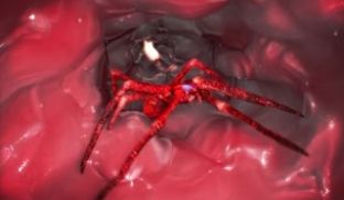 ULALA x SPIDER Part 1