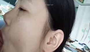 (41)