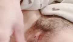 7a