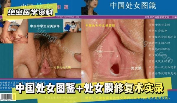 【绝密医学资料】中国处女图鉴处女膜修复术实录