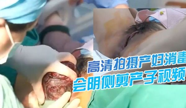 震撼流出高清拍摄产妇消毒会阴会阴侧剪产子视频流出
