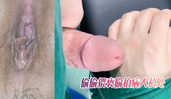 麻醉科.色狼医生趁.美女术前.麻.醉的时.候_旁